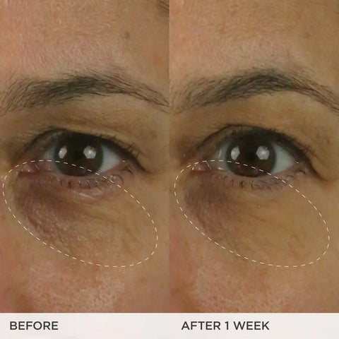 The Brightening Eye Cream